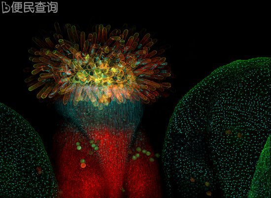 最佳年度生物显微照片，水蚤微观照居首