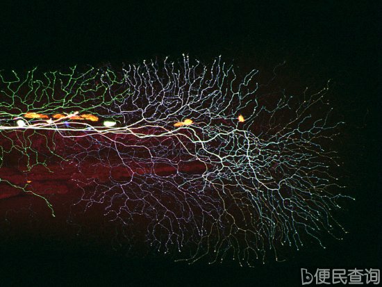 最佳年度生物显微照片，水蚤微观照居首